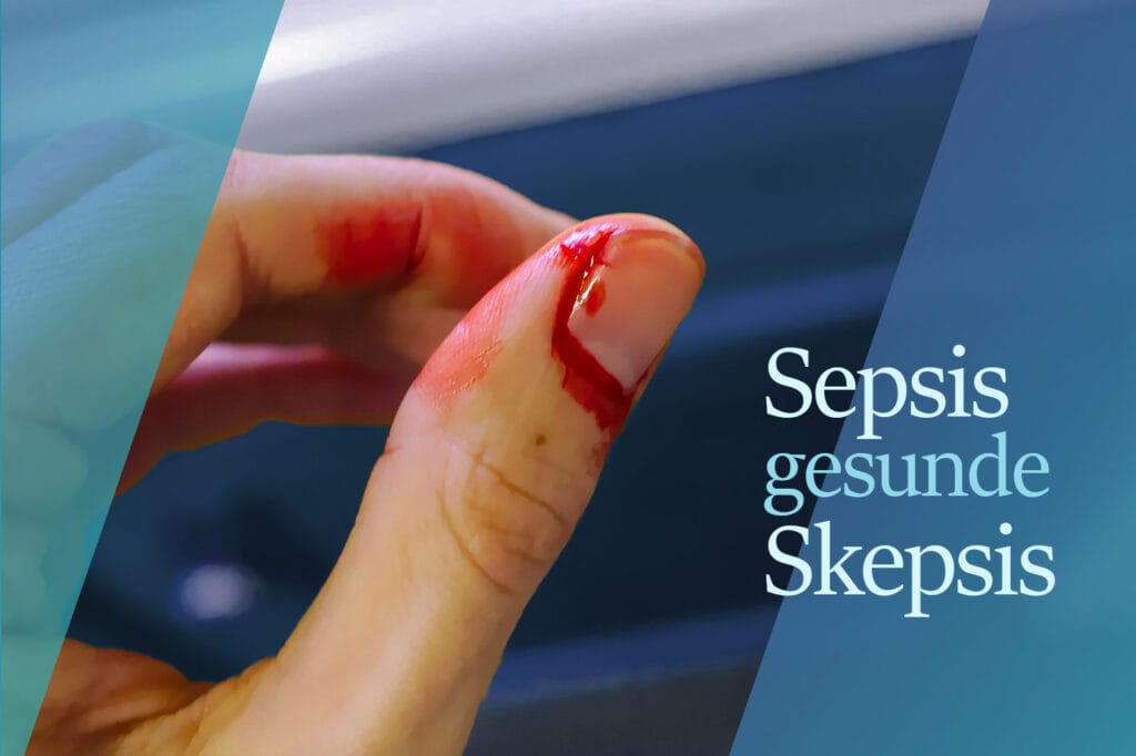 Gegen Sepsis ankämpfen durch gesunde Skepsis.